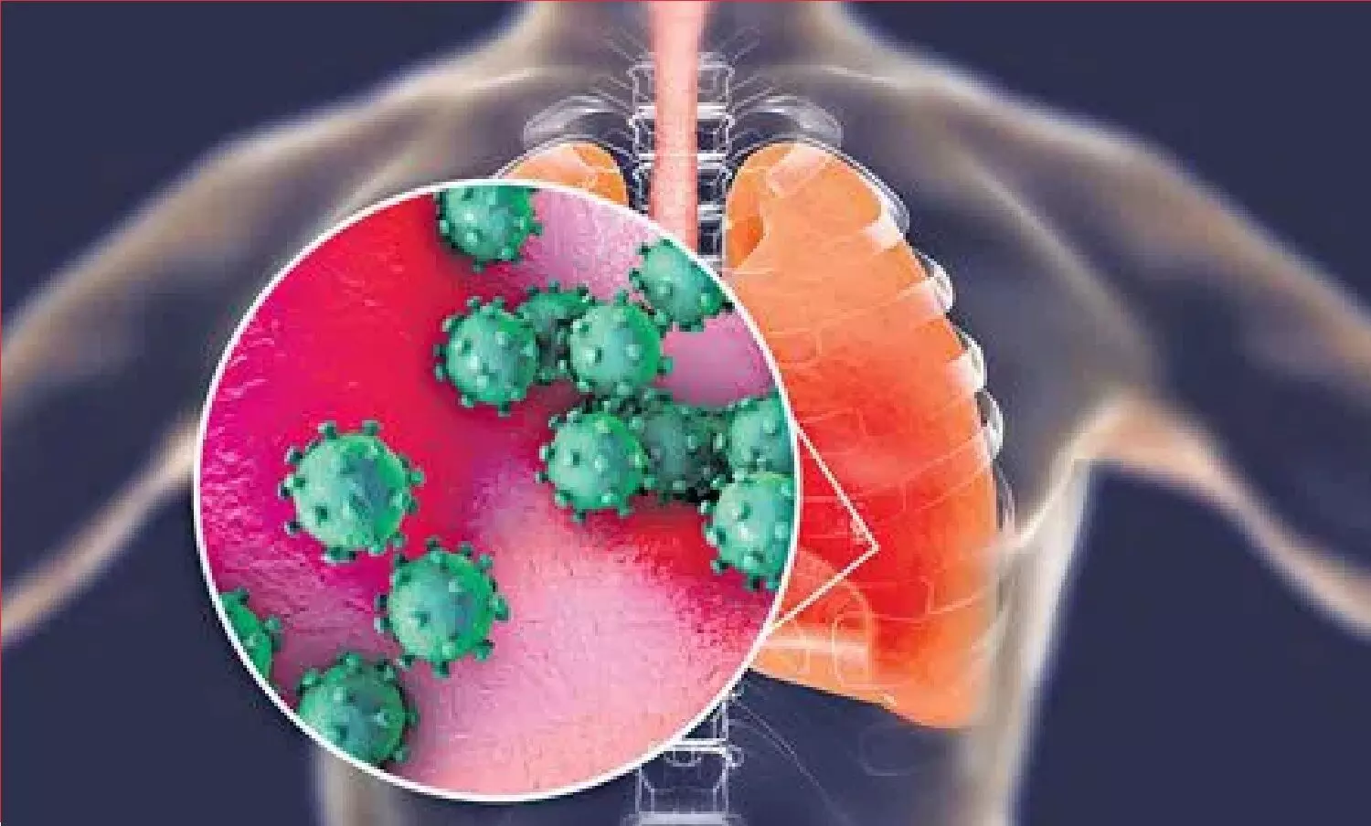 Influenza A Virus Subtype H3N2 से देश में पहली बार मौत! कर्नाटक-हरियाणा के दो मरीजों की मौत, कोरोना की तरह फ़ैल रहा संक्रमण