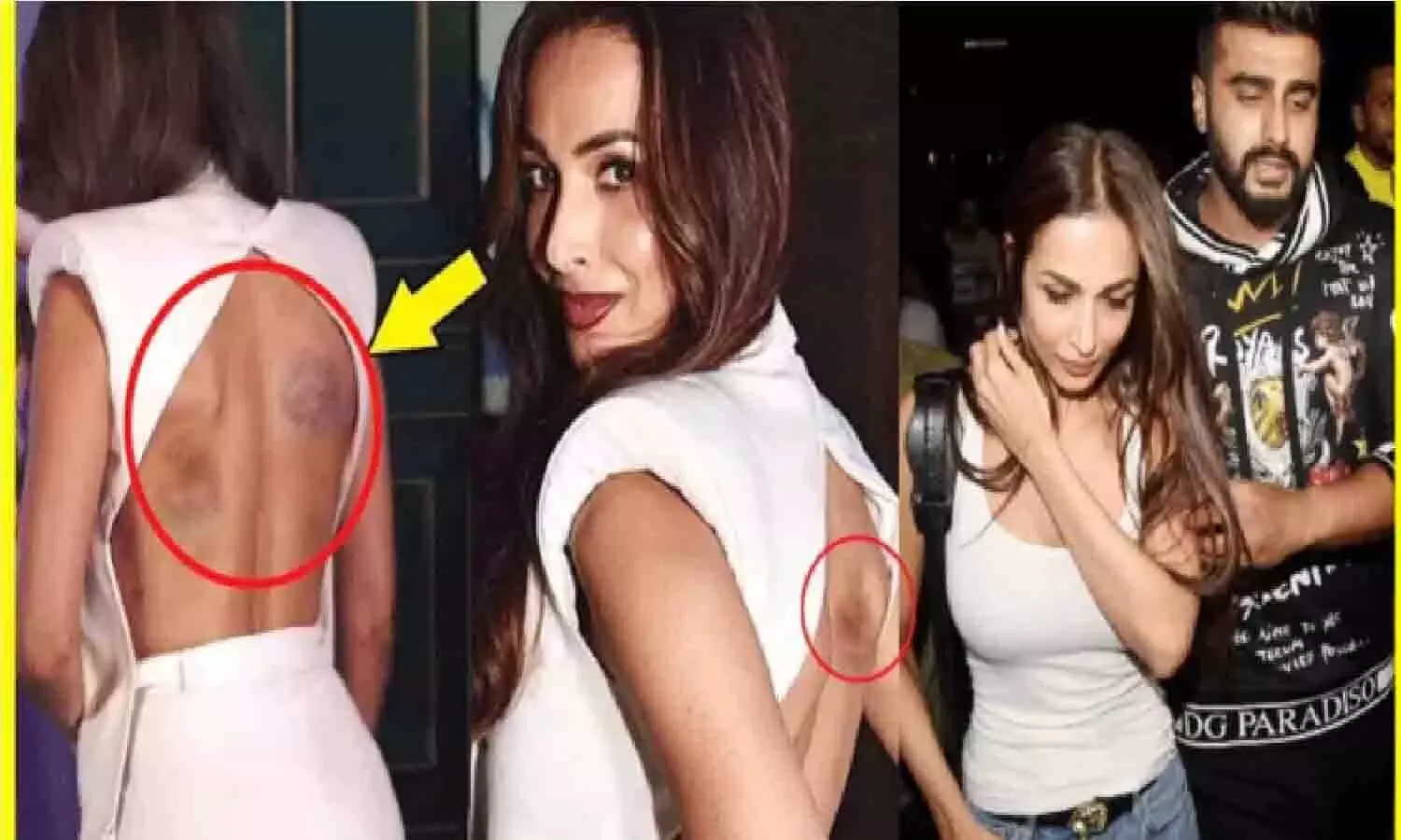 Malaika Arora की Arjun Kapoor ने पहली रात कर दी थी ऐसी हालत....